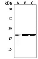 TUSC1 Rabbit Polyclonal Antibody