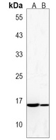 NT5C Rabbit Polyclonal Antibody