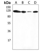 THSD1 Rabbit Polyclonal Antibody