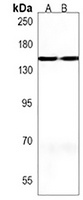 MTUS2 Rabbit Polyclonal Antibody