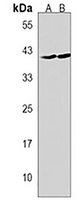 GMPPB Rabbit Polyclonal Antibody