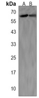 SLC5A8 Rabbit Polyclonal Antibody