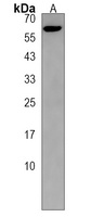 ZBTB18 Rabbit Polyclonal Antibody