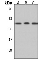 SAPCD2 Rabbit Polyclonal Antibody