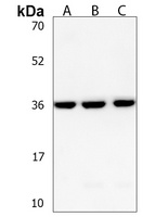 HUG1 Rabbit Polyclonal Antibody