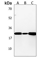 KCTD11 Rabbit Polyclonal Antibody