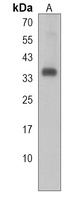 RNF126 Rabbit Polyclonal Antibody