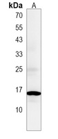 ATP5G3 Rabbit Polyclonal Antibody