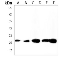UQCRFS1P1 Rabbit Polyclonal Antibody