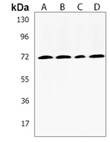 TMEM16K Rabbit Polyclonal Antibody