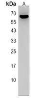 FBXO33 Rabbit Polyclonal Antibody