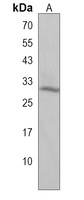PTGFR Rabbit Polyclonal Antibody
