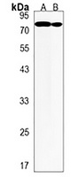 AHI1 Rabbit Polyclonal Antibody