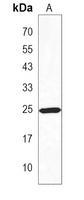 PET1 Rabbit Polyclonal Antibody