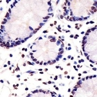 PET1 Rabbit Polyclonal Antibody
