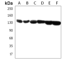 SRGAP2 Rabbit Polyclonal Antibody