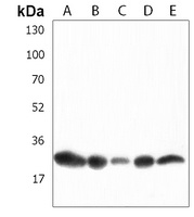 HNRNPA1L2 Rabbit Polyclonal Antibody