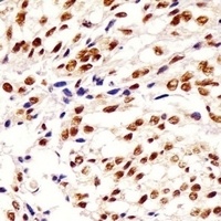 HNRNPA1L2 Rabbit Polyclonal Antibody