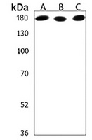 IQSEC2 Antibody