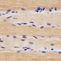 USP47 Rabbit Polyclonal Antibody