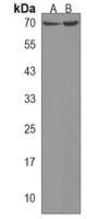 ZNF257 Rabbit Polyclonal Antibody