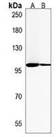 URGCP Rabbit Polyclonal Antibody