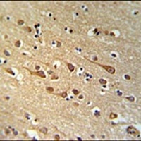 URGCP Rabbit Polyclonal Antibody