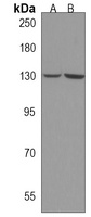 GALNT5 Rabbit Polyclonal Antibody