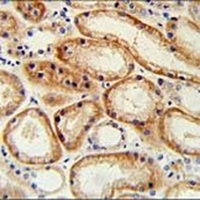 GALNT5 Rabbit Polyclonal Antibody