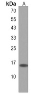 BOD1 Rabbit Polyclonal Antibody