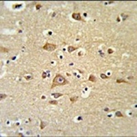 BOD1 Rabbit Polyclonal Antibody