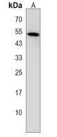 DDX49 Rabbit Polyclonal Antibody