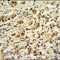 DDX49 Rabbit Polyclonal Antibody