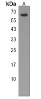 SNX27 Rabbit Polyclonal Antibody