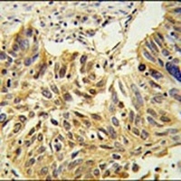 SDPR Rabbit Polyclonal Antibody