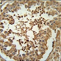 C3orf58 Rabbit Polyclonal Antibody