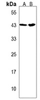 PRPF38A Rabbit Polyclonal Antibody