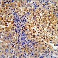 PRPF38A Rabbit Polyclonal Antibody