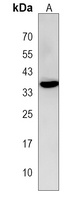 NSMCE4A Rabbit Polyclonal Antibody