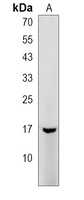 TYROBP Rabbit Polyclonal Antibody
