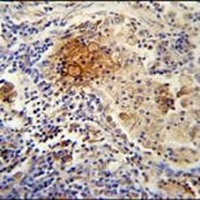 TYROBP Rabbit Polyclonal Antibody