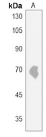 ACSBG2 Rabbit Polyclonal Antibody