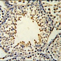ACSBG2 Rabbit Polyclonal Antibody
