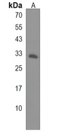 HSD17B11 Rabbit Polyclonal Antibody