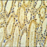 HSD17B11 Rabbit Polyclonal Antibody
