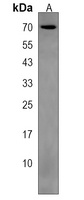 LRRTM1 Rabbit Polyclonal Antibody