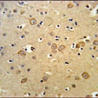 LRRTM1 Rabbit Polyclonal Antibody