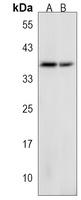 GSPT2 Rabbit Polyclonal Antibody