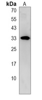 ECHDC1 Rabbit Polyclonal Antibody