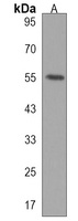 CENPI Rabbit Polyclonal Antibody